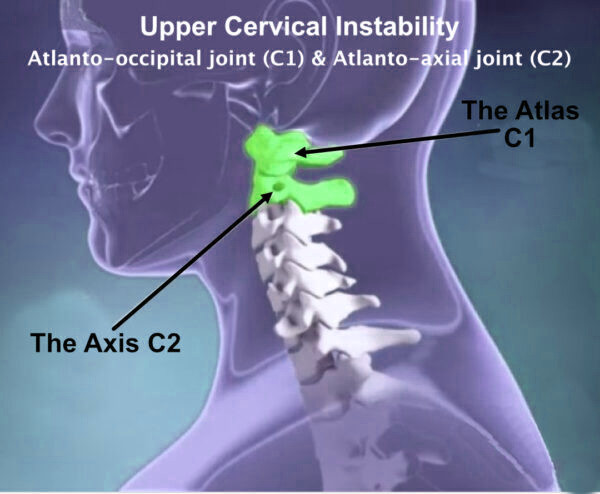 upper cervical spine diagram